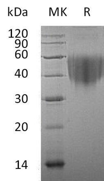 Human CD80/B7 Recombinant Protein (RPES1381)