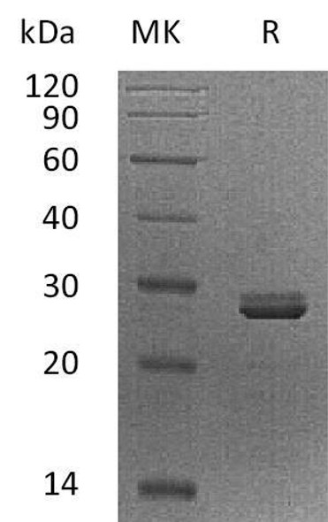 Human PDCD10/TFAR15 Recombinant Protein (RPES1388)