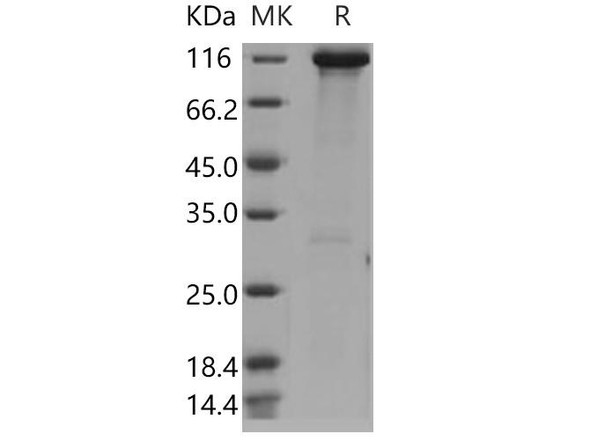 Human Hexokinase-3/HK3 Recombinant Protein (RPES1397)