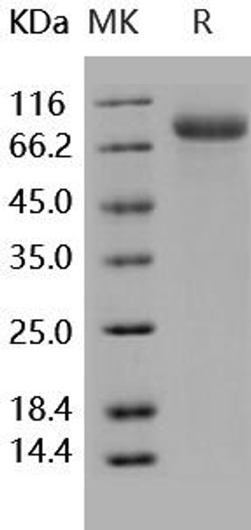 Human Endoglin/CD105 Recombinant Protein (RPES1401)