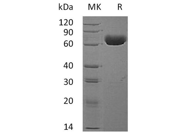 Human EphA4 Recombinant Protein (RPES1405)