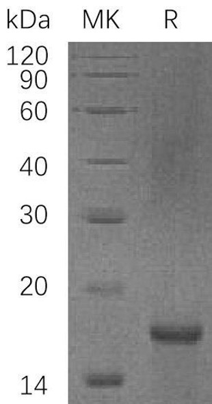 Human PDCD4/H731 Recombinant Protein (RPES1408)