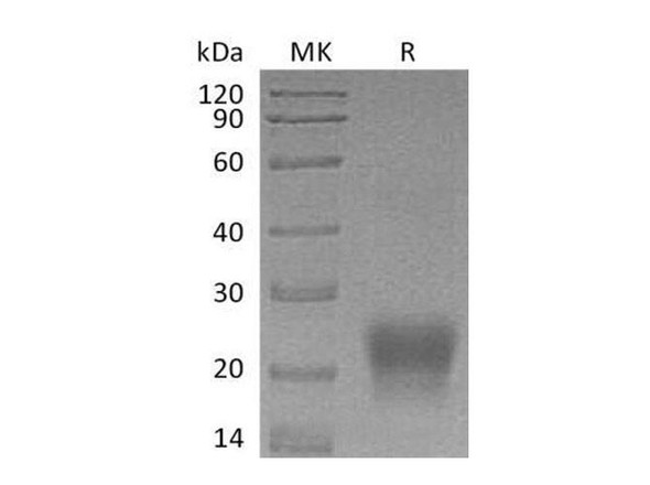 Human Tetherin/BST2 Recombinant Protein (RPES1415)