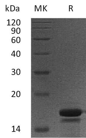 Human PDCD5/TFAR19 Recombinant Protein (RPES1428)