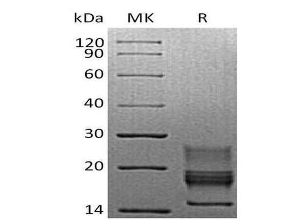 Mouse Interferon gamma/IFNG Recombinant Protein (RPES1431)
