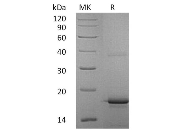 Human Interleukin-33/IL-33 Recombinant Protein (RPES1454)