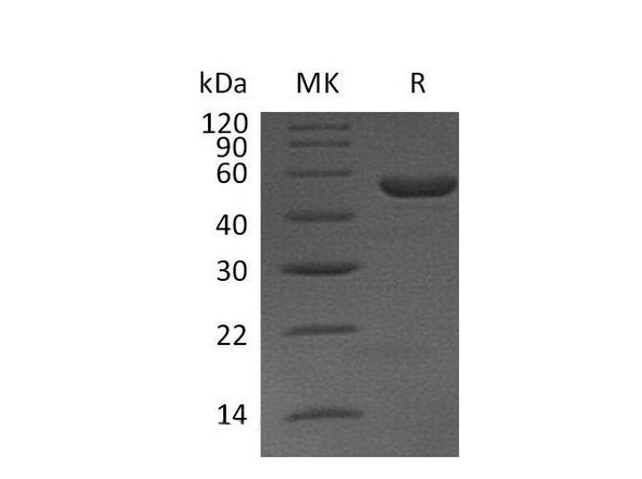 Mouse Interleukin1/IL1 Recombinant Protein (RPES1455)