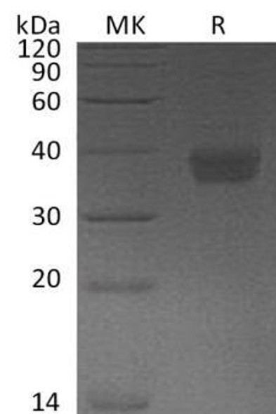 Human PD-L1/B7-H1/CD274 Recombinant Protein (RPES1466)
