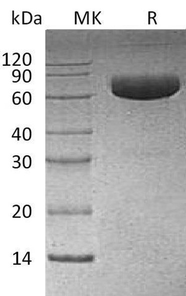 Human PD-L1/B7-H1/CD274 Recombinant Protein (RPES1486)