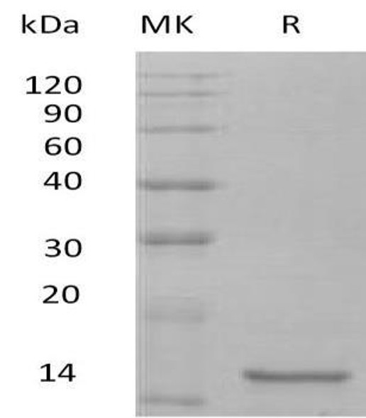 Mouse Interleukin0/IL0 Recombinant Protein (RPES1508)