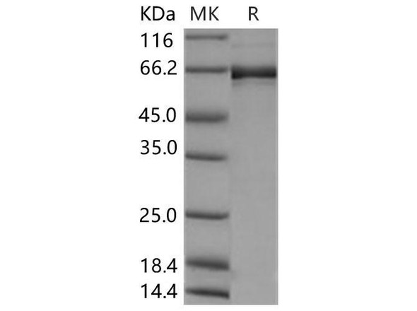 Human EphB2 Recombinant Protein (RPES1514)