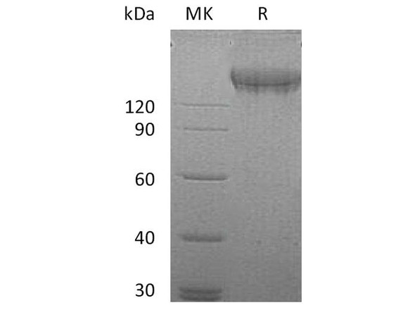 Human VEGFR2/Flk/KDR Recombinant Protein (RPES1522)