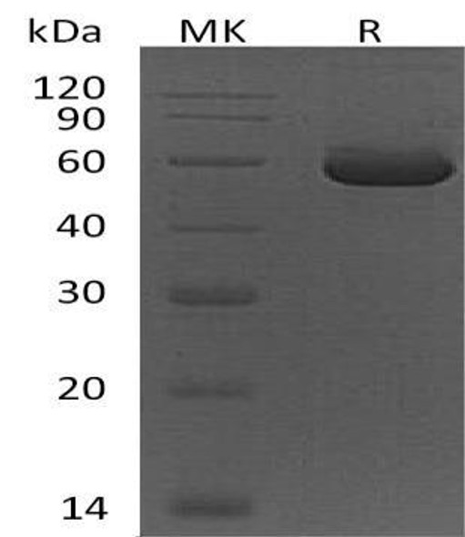 Human Peptidase D/PEPD Recombinant Protein (RPES1525)