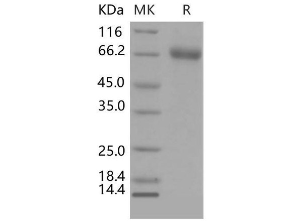 Mouse EphA1 Recombinant Protein (RPES1527)