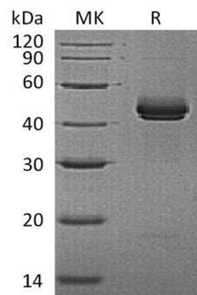 Mouse IL2 p40/IL2B Recombinant Protein (RPES1528)