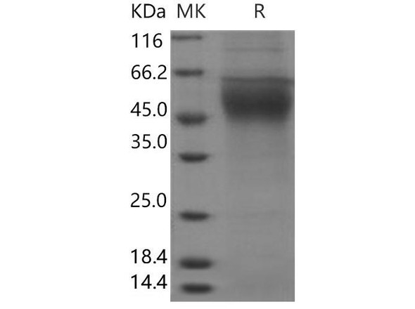 Human FLT1 Recombinant Protein (RPES1538)