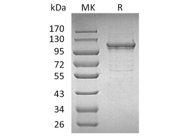 Human IDE/Insulysin Recombinant Protein (RPES1543)