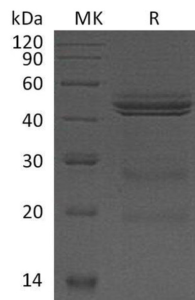 Mouse Interleukin2/IL2 Recombinant Protein (RPES1547)