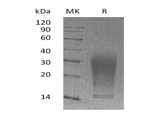 Mouse Interleukin3/IL3 Recombinant Protein (RPES1567)