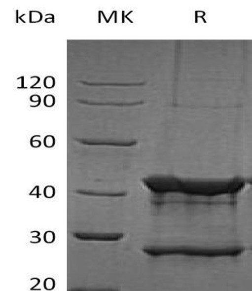 Human UBE2D1 Recombinant Protein (RPES1575)