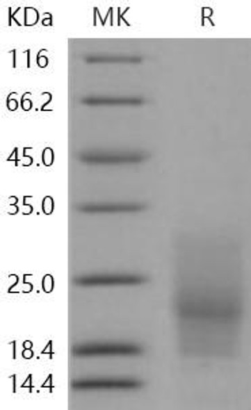 CD63/Tspan-30/Tetraspanin-30 Recombinant Protein (RPES1599)