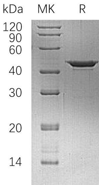 Cystathionine gamma-Lyase Recombinant Protein (RPES1619)