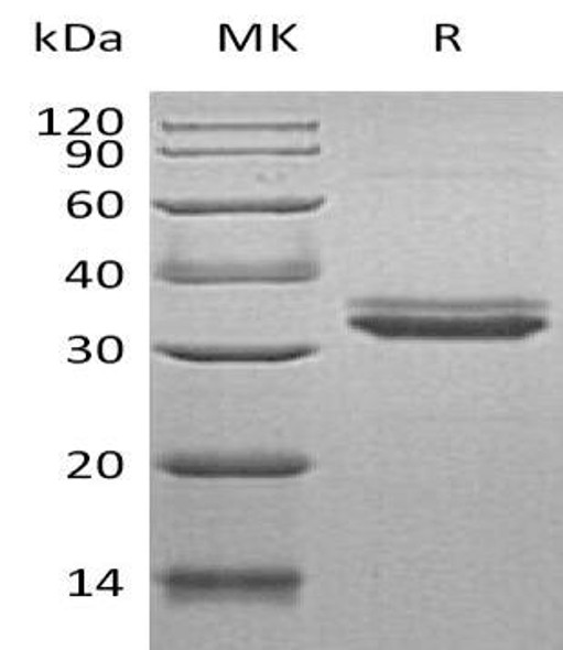 Human IGFBP-4/IGFBP4 Recombinant Protein (RPES1620)