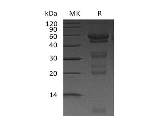 Mouse HGF Recombinant Protein (RPES1630)