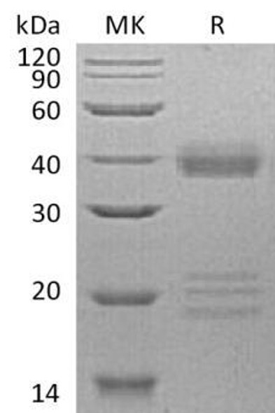Human IGFBP-5/IGFBP5 Recombinant Protein (RPES1641)