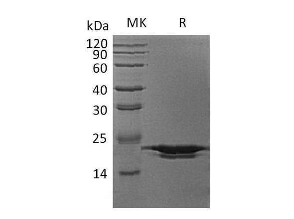 Human PPIH Recombinant Protein (RPES1642)