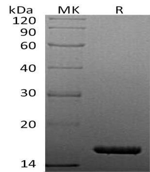 Human TNF-alpha/TNFA Recombinant Protein (RPES1643)