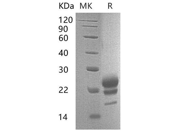 Mouse Interleukin7F/IL7F Recombinant Protein (RPES1645)