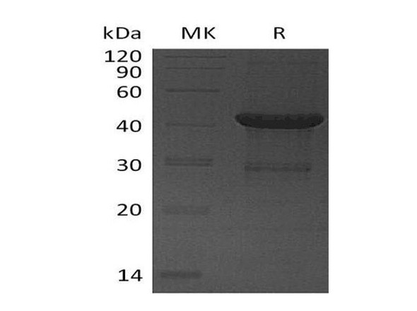 Human UBE2D4 Recombinant Protein (RPES1649)