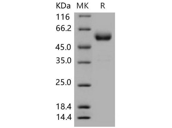 Mouse CTLA4/CD152 Recombinant Protein (RPES1658)