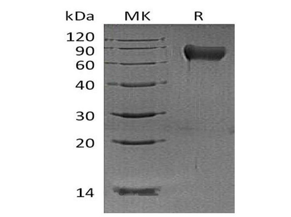 Mouse Hemopexin/HPX Recombinant Protein (RPES1672)