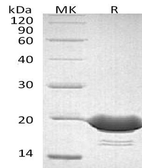 Human 4BBL/TNFSF9 Recombinant Protein (RPES1680)