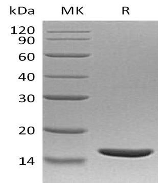 Human TNF beta/TNFB Recombinant Protein  (RPES1684)