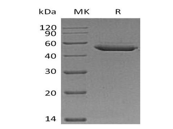 Mouse SerpinE2/SERPINE2 Recombinant Protein (RPES1692)