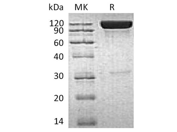 Human ICAM/CD54 Recombinant Protein (RPES1702)
