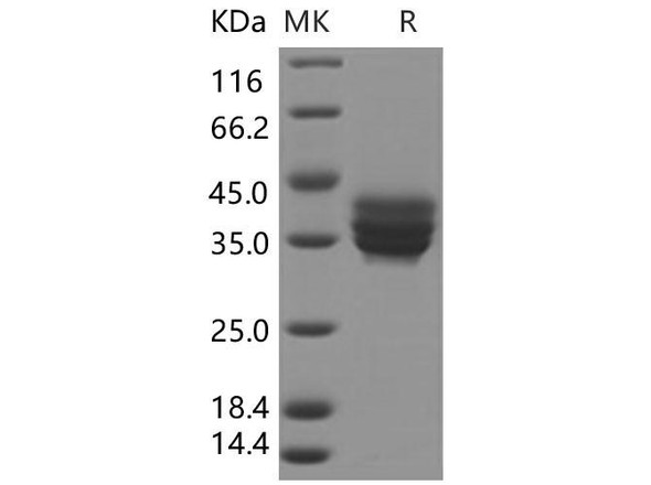 Human TNFRSF17/BCMA Recombinant Protein (RPES1715)