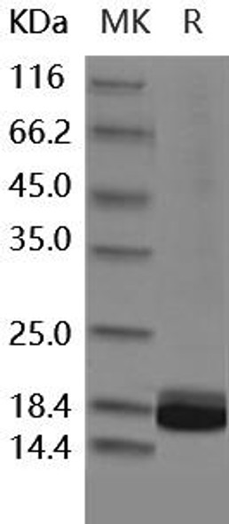 Human IL1F5/IL36RN Recombinant Protein (RPES1716)