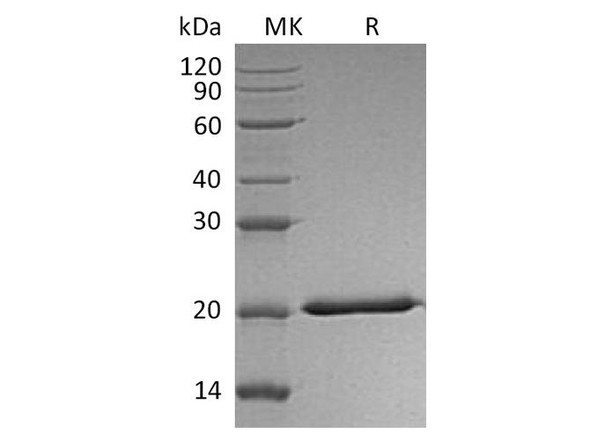 Interferon Lambda-2/IL-28A Recombinant Protein (RPES1722)
