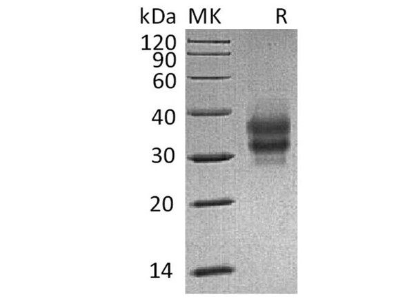 Mouse FOLR1 Recombinant Protein (RPES1732)
