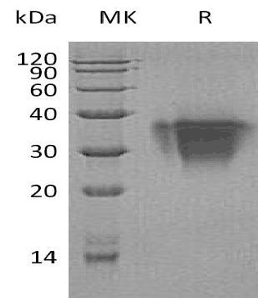 Human TWSG1/TSG Recombinant Protein (RPES1743)