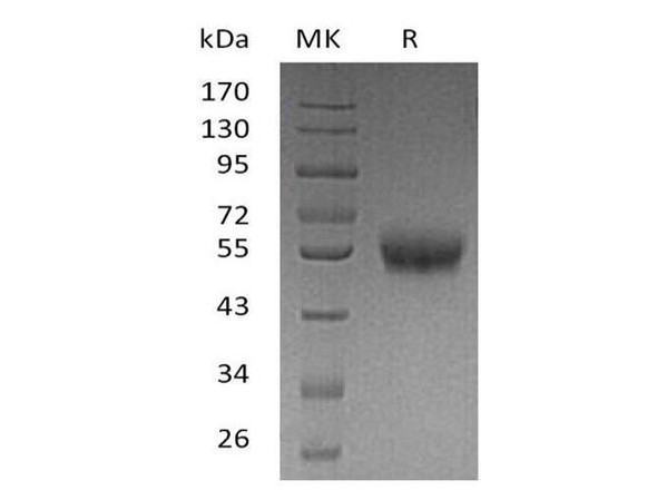 Human 4BB/TNFRSF9 Recombinant Protein (RPES1760)