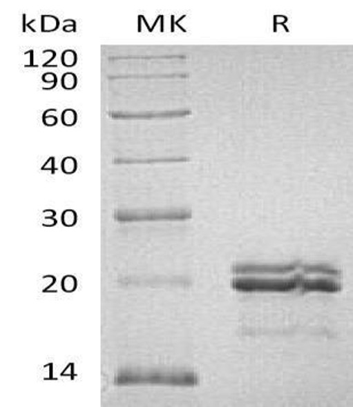 Human MAX Recombinant Protein (RPES1773)