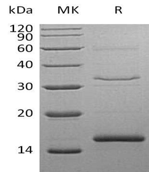 Human Cystatin S/CST4 Recombinant Protein (RPES1780)