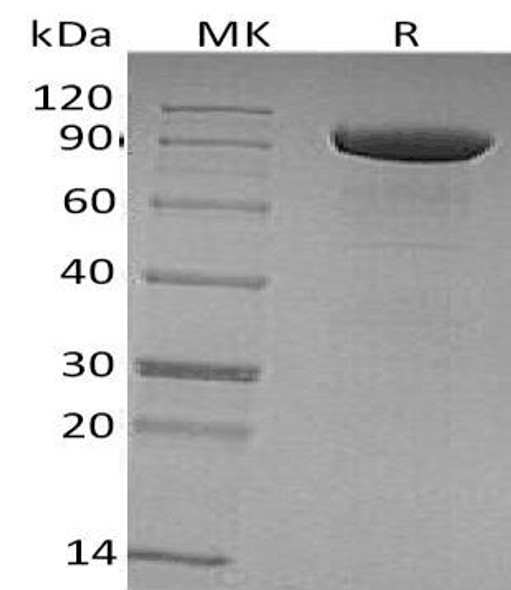 Human Tie1 Recombinant Protein (RPES1783)