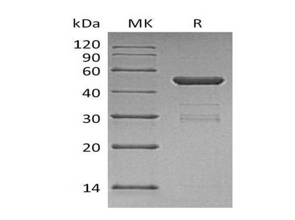 Human Ube2H Recombinant Protein (RPES1789)