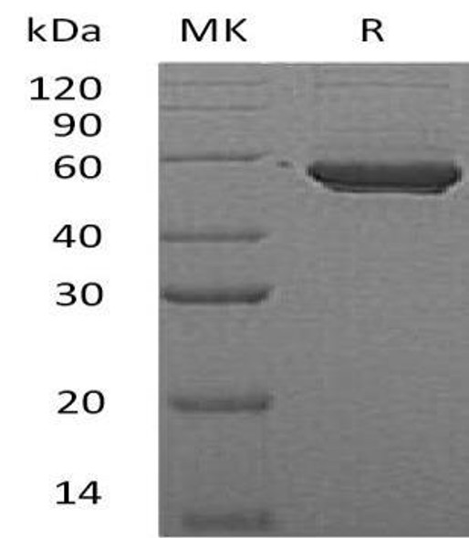 Human PIP4K2A Recombinant Protein (RPES1803)